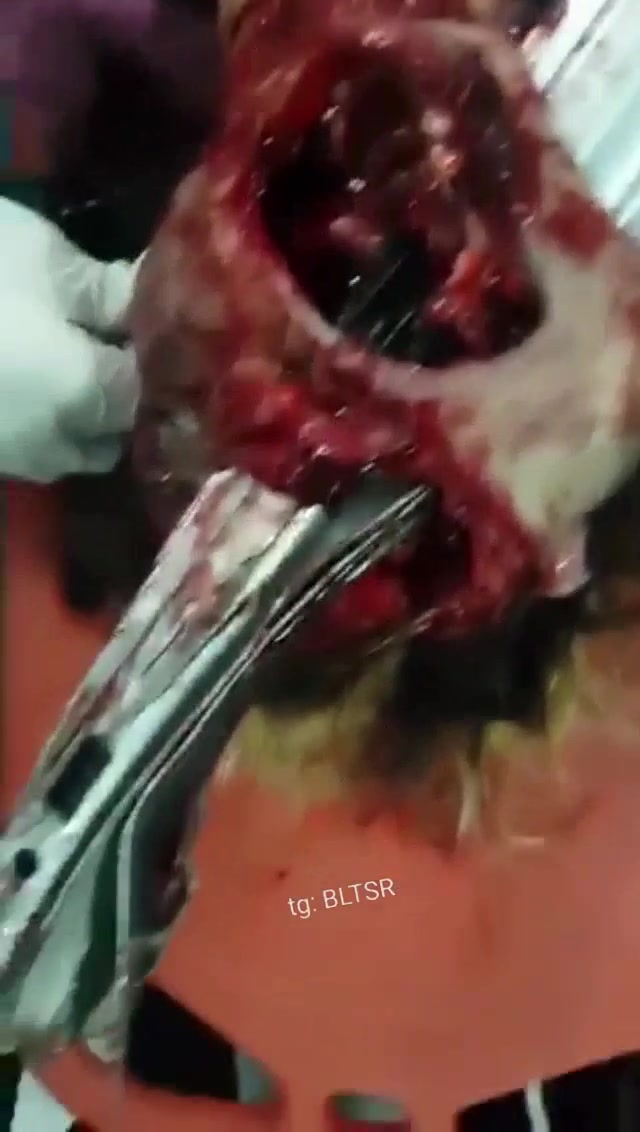 Китай, жертва аварии.