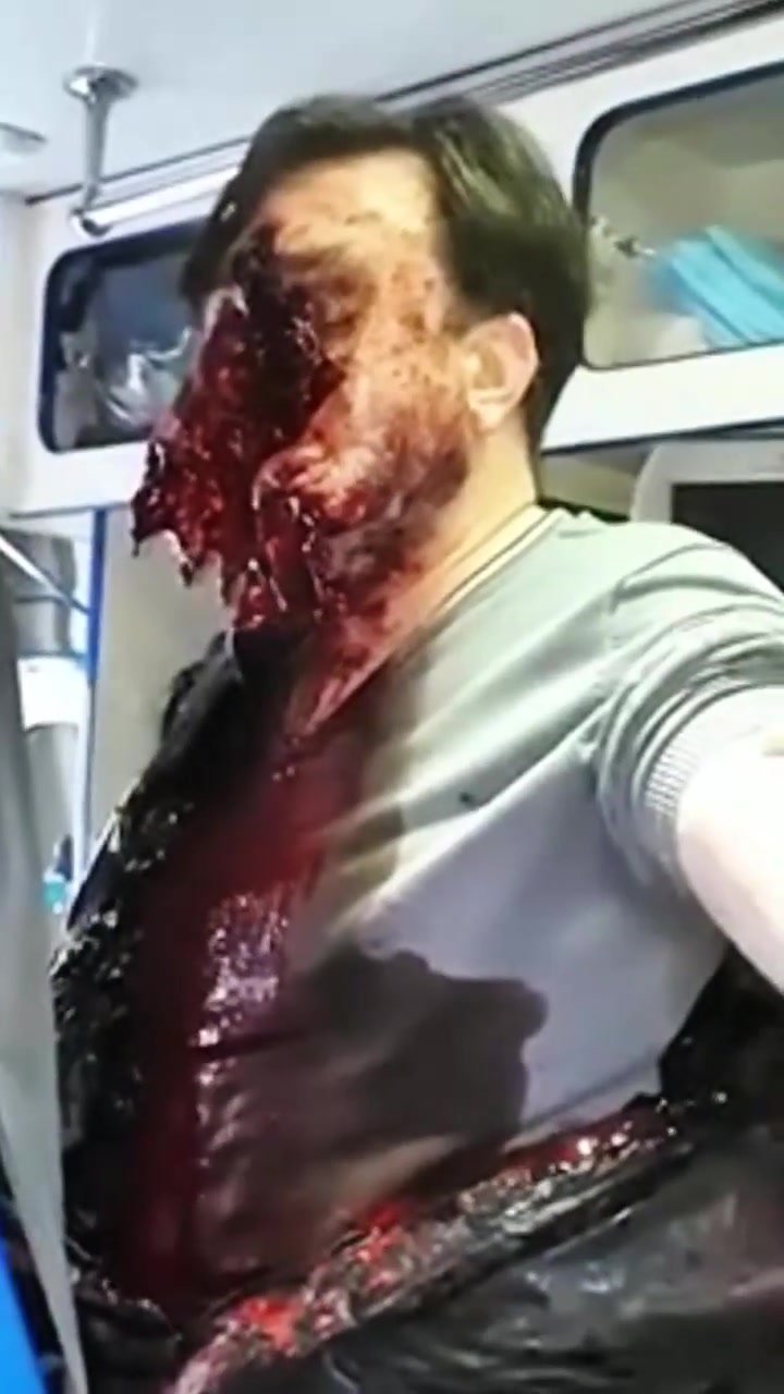 Неудачное самоубийство