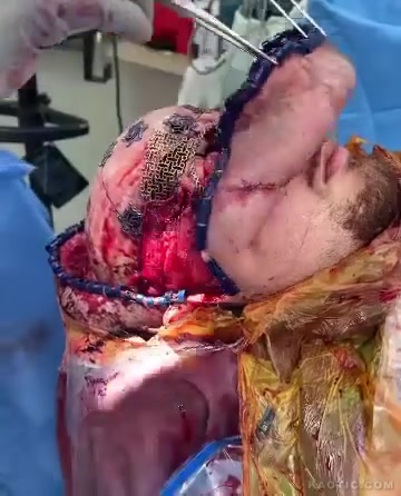 Некая процедура.