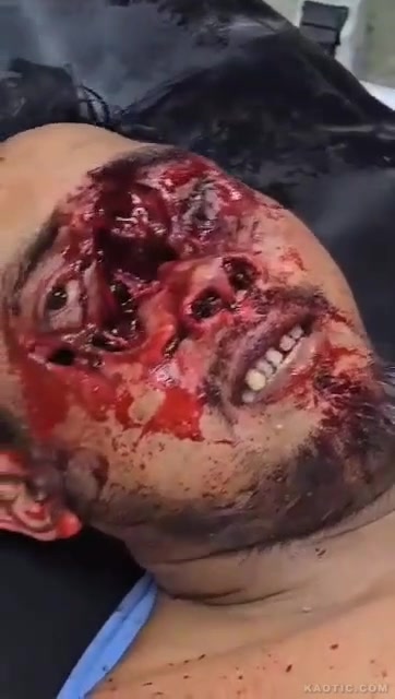 Выстрелили в лицо