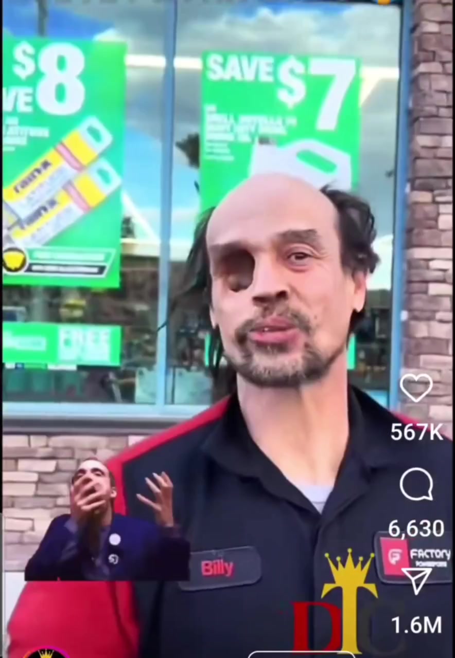 Ивалид пол башки