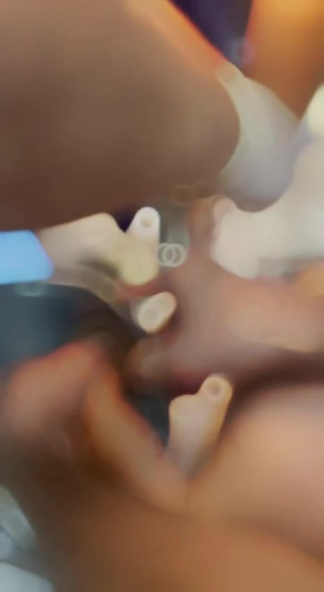 Попал в мясорубку.