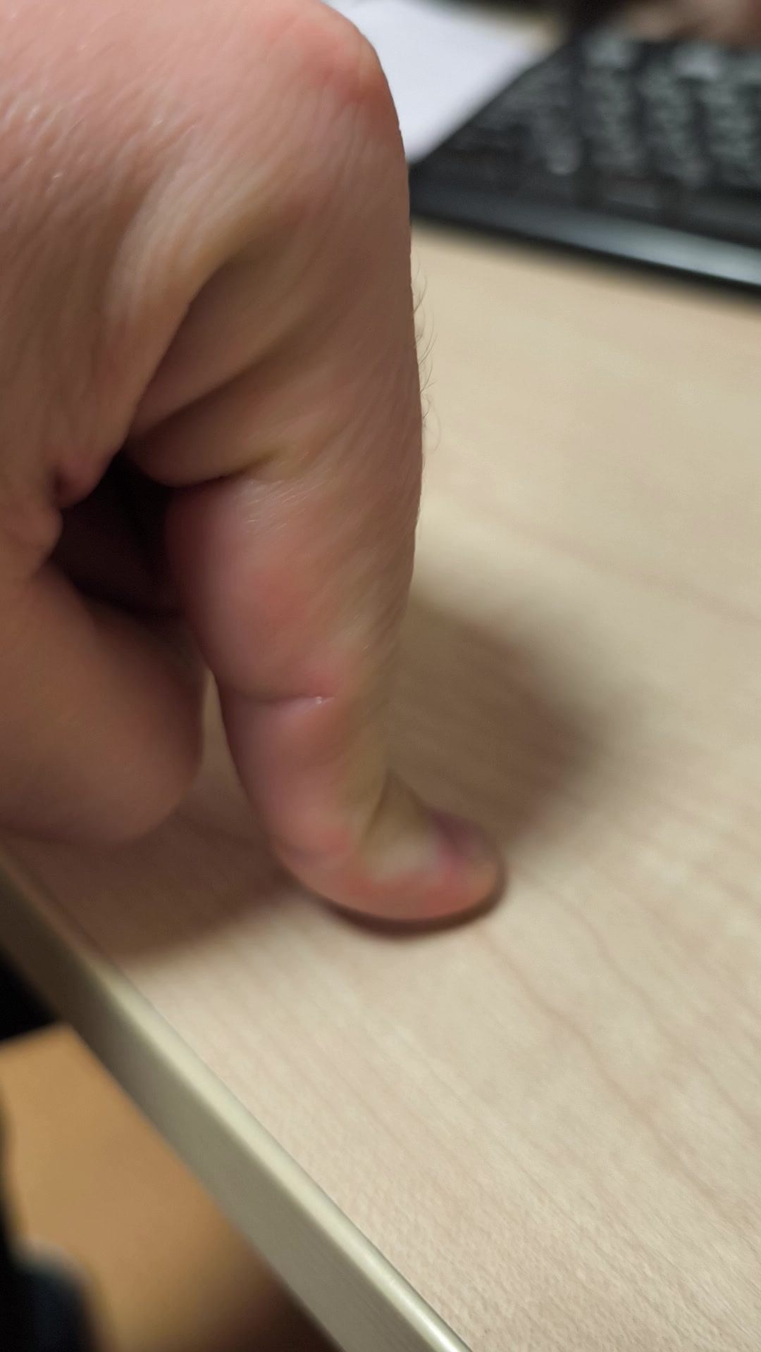 Пальцы гнутся